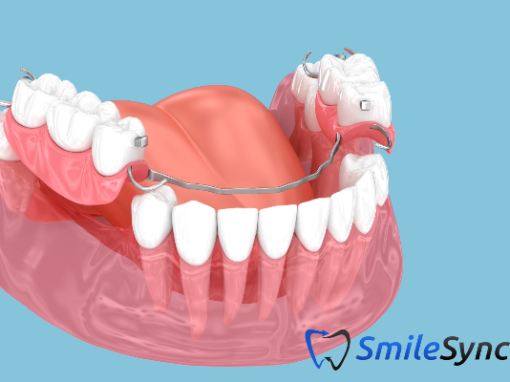 Cobalt Chrome Denture
