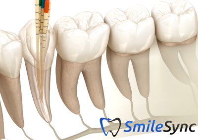 Root Canal Treatment