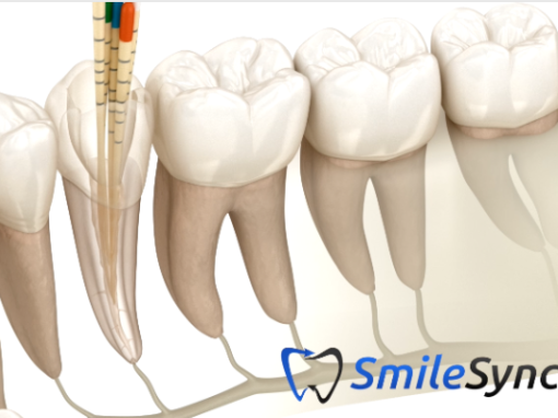 Root Canal Treatment