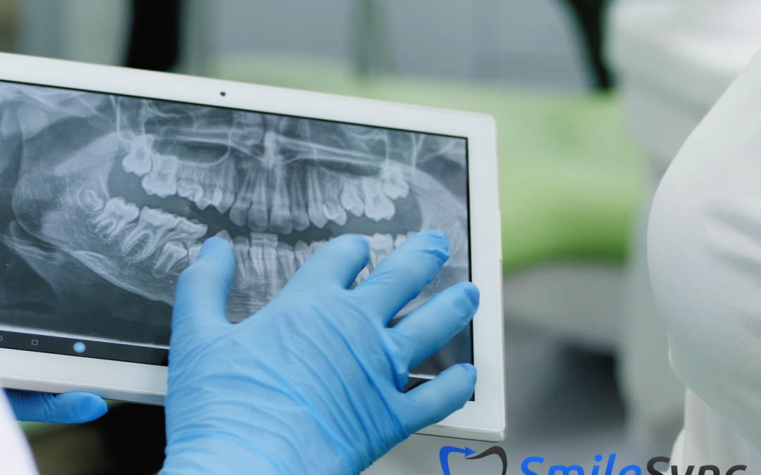 X-Rays (Radiographs)